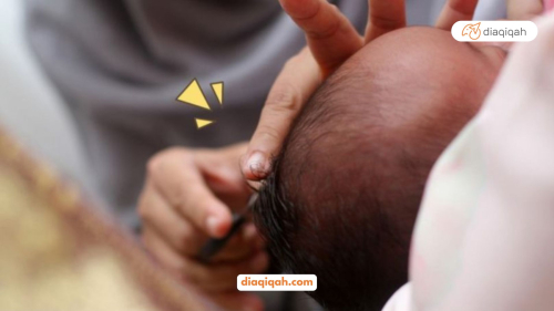 Gambar Berikut Ini Beberapa Hal Penjelasan Mengenai Aqiqah